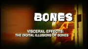 Bones