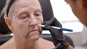 Skin Decision: Before and After