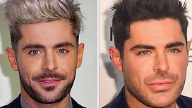 Bradley Cooper, Zac Efron, Ryan Gosling… ces hommes qui ont eu recours à la chirurgie esthétique, ou qui en sont suspectés (photos)