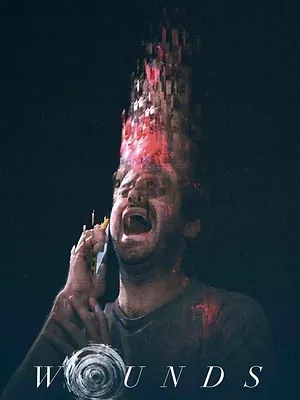 Wounds