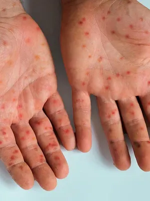 Reconstruire leurs visages