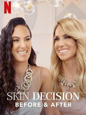 Skin Decision: Before and After