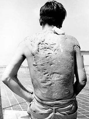 Sous le nuage d'Hiroshima