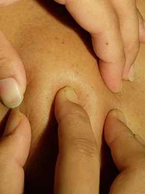 SOS Dermato