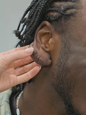 SOS Dermato