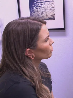 Dr Pimple Popper
