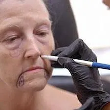 Skin Decision: Before and After