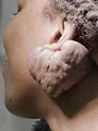 SOS Dermato
