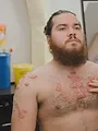SOS Dermato