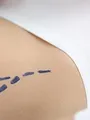 Chirurgie à tout prix S2 E4
