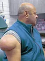 Dr Pimple Popper