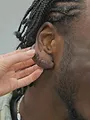 SOS Dermato