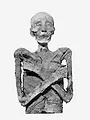 Mysteries of Ancient Medicine